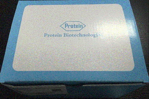血清血浆microRNA提取试剂盒（PR610）